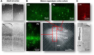 Self-Organized Criticality in the Brain